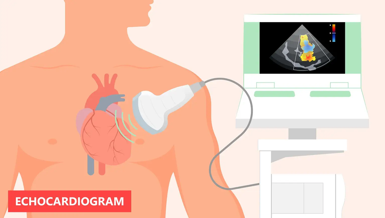 Echocardiogram diagram copy